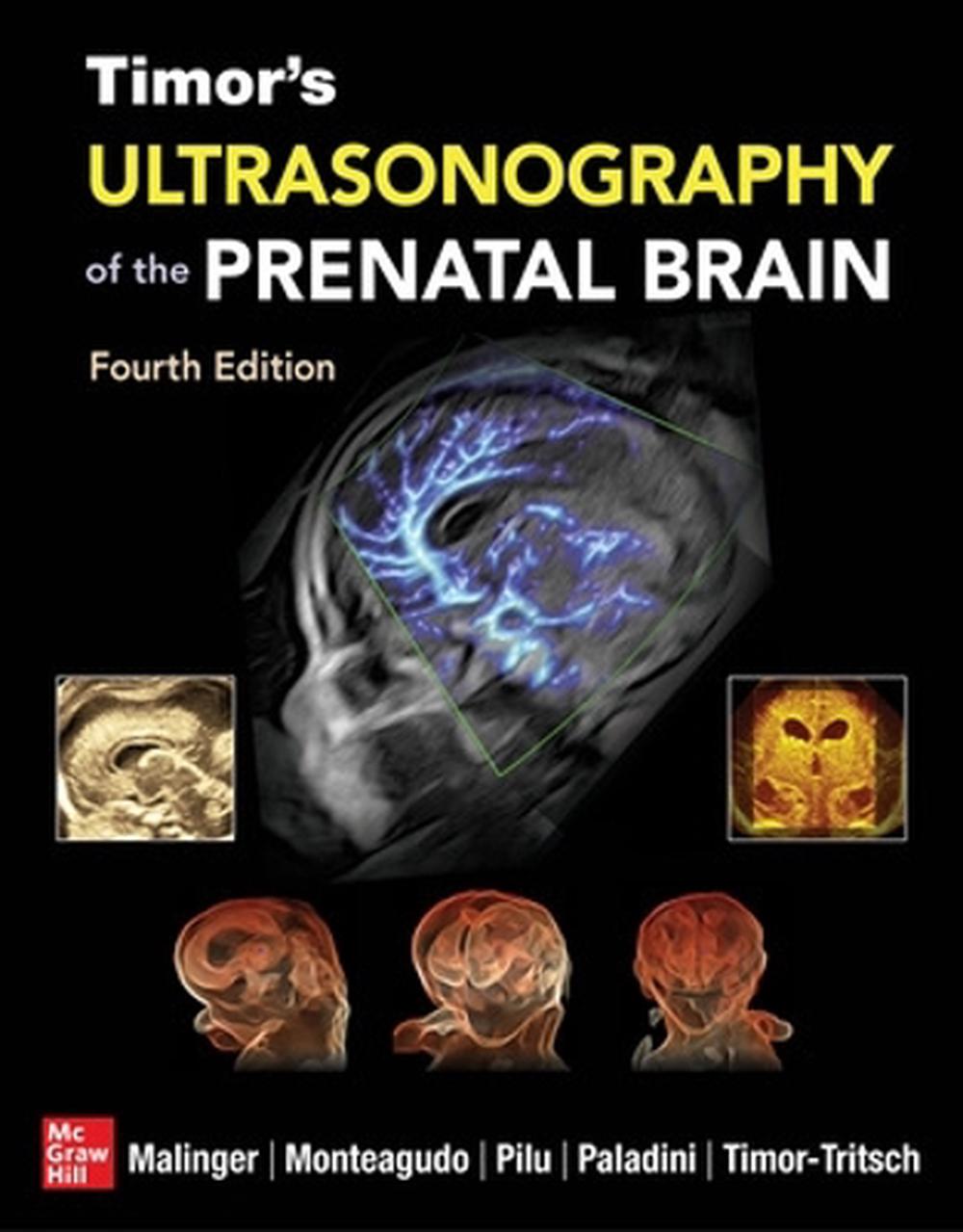 Timor's Ultrasonography of the Prenatal Brain, Fourth Edition, 9781260136166