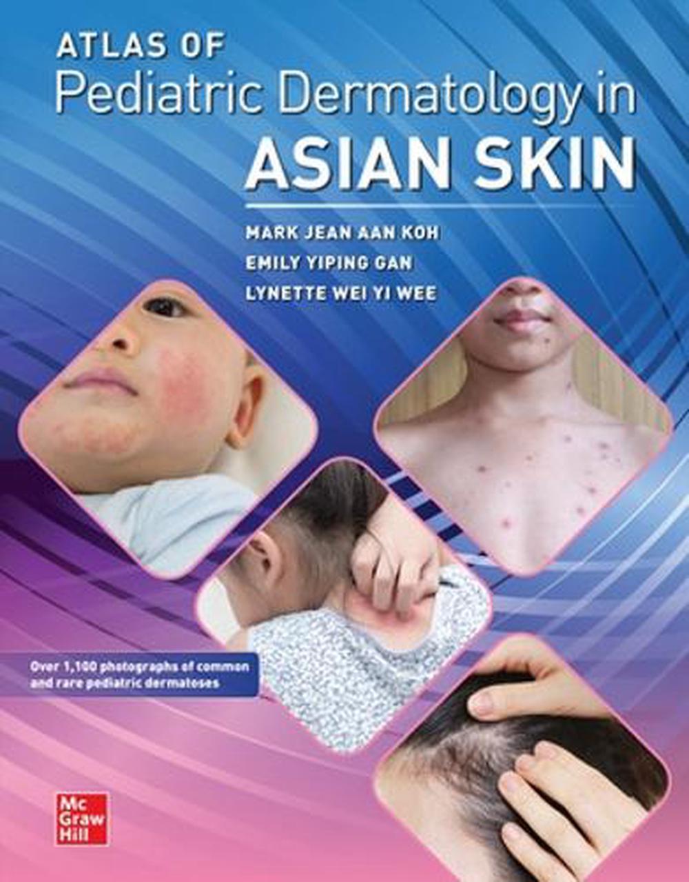 Atlas of Pediatric Dermatology in Asian Skin, 9781264267019