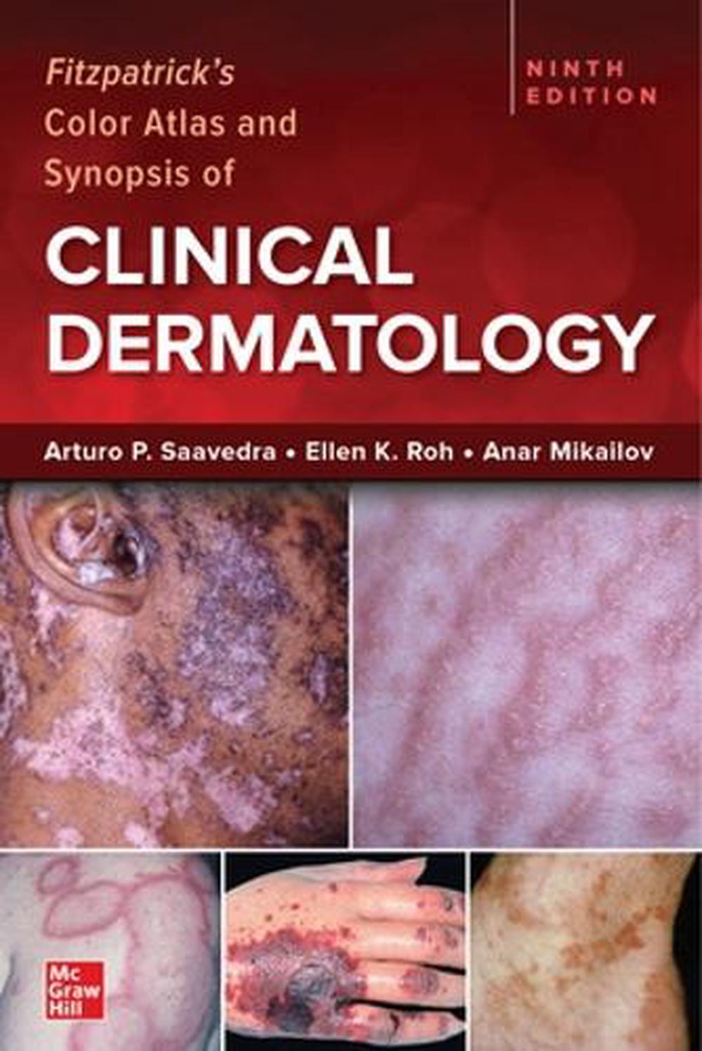 Fitzpatrick's Color Atlas and Synopsis of Clinical Dermatology, Ninth Edition, 9781264278015