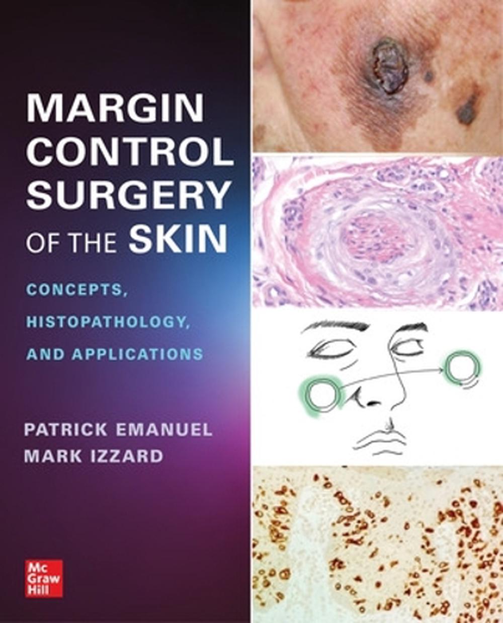 Margin Control Surgery of the Skin: Concepts, Histopathology, and Applications, 9781264285990
