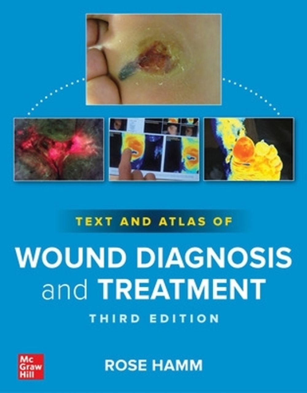 Text and Atlas of Wound Diagnosis and Treatment, Third Edition, 3rd Edition by Rose Hamm - ISBN: 9781264923106