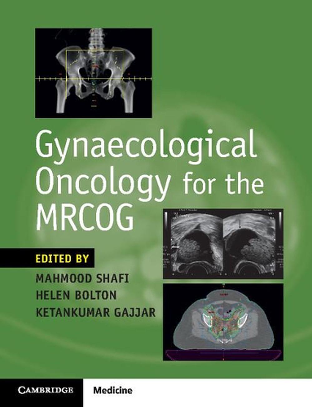 Gynaecological Oncology for the MRCOG, 9781316638712