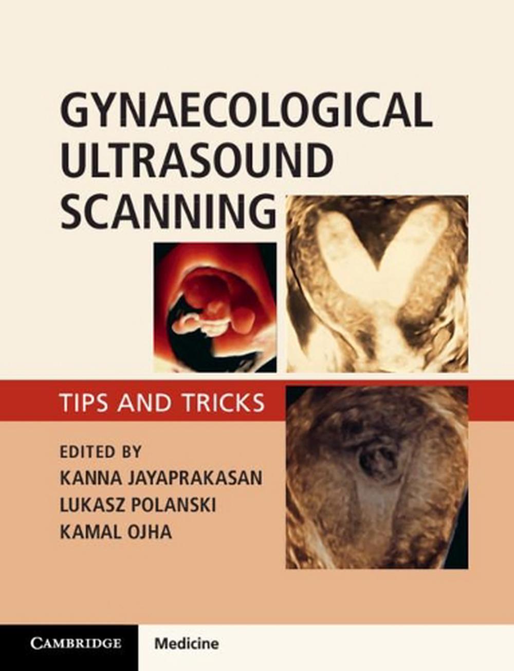 Gynaecological Ultrasound Scanning, 9781316645178