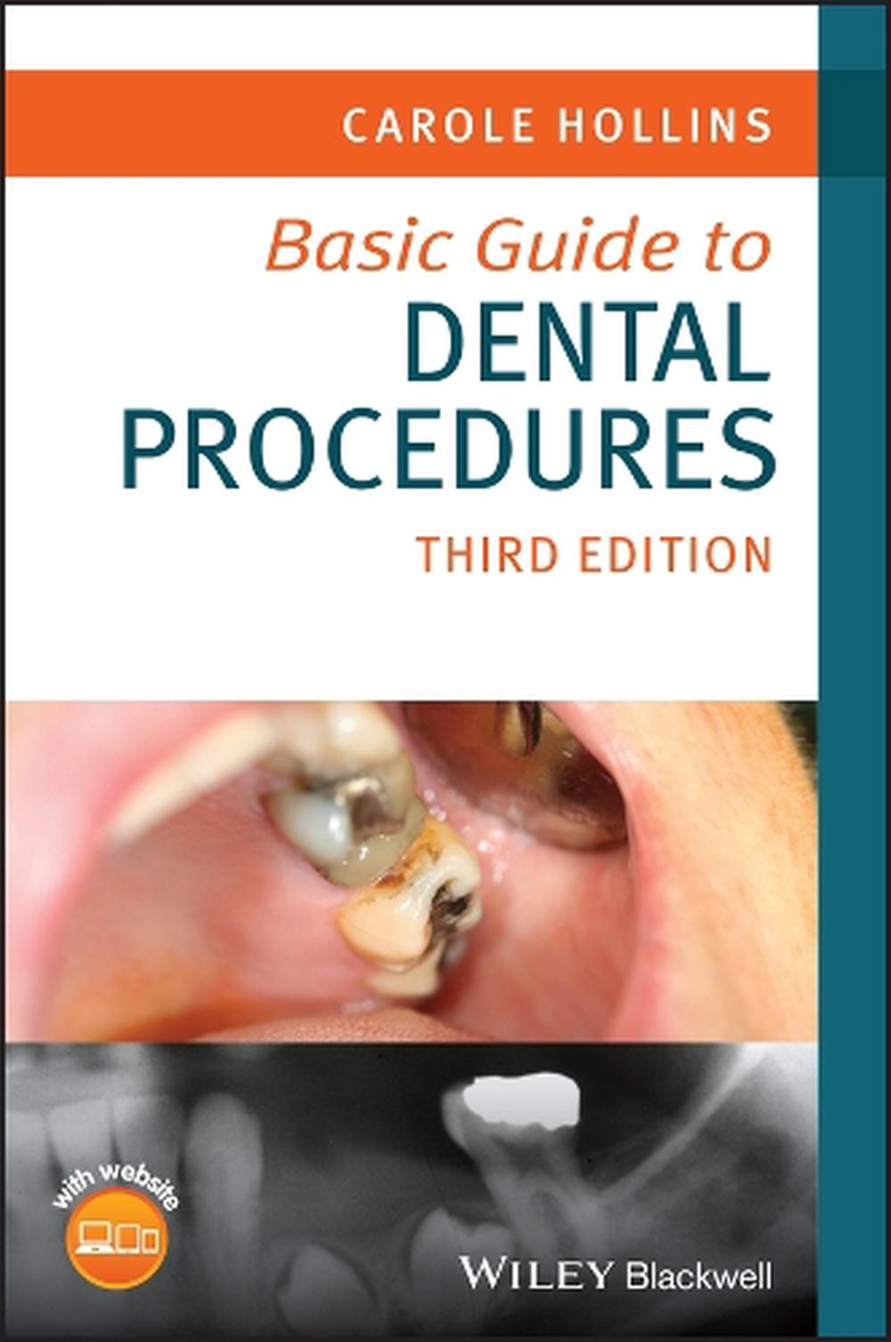 Basic Guide to Dental Procedures, 9781394187874