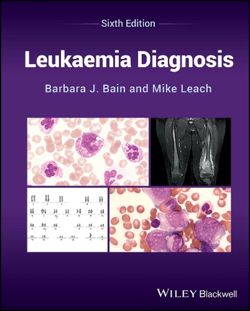 Leukaemia Diagnosis, 9781394218585
