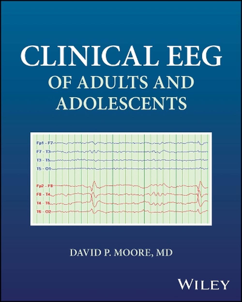 Clinical EEG of Adults and Adolescents, 9781394315345