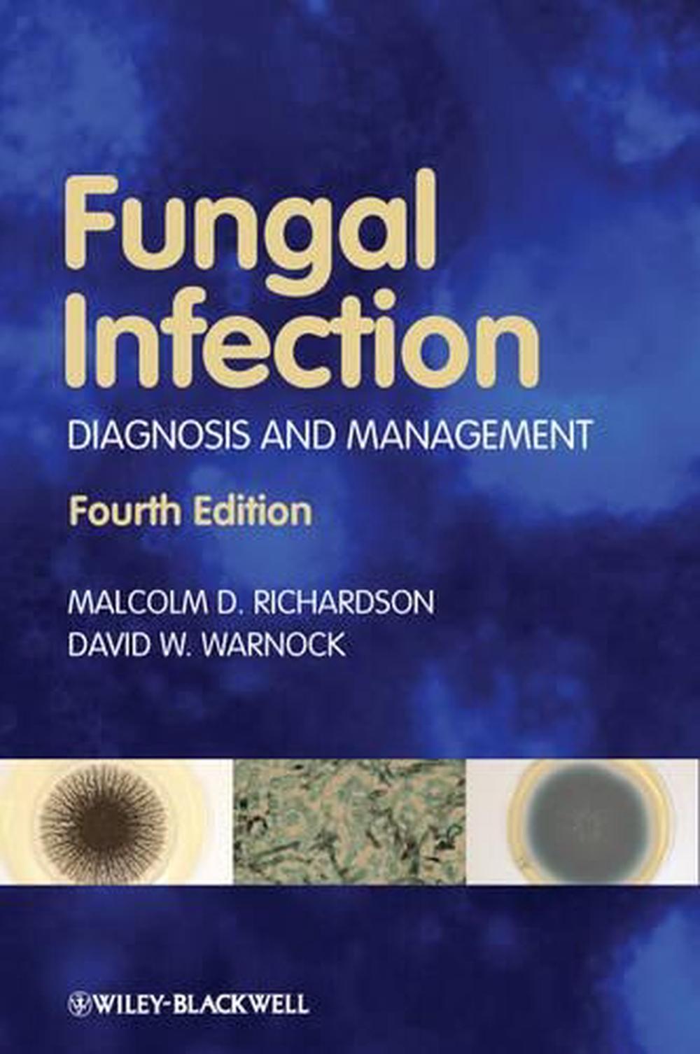 Fungal Infection, 4th Edition, 9781405170567