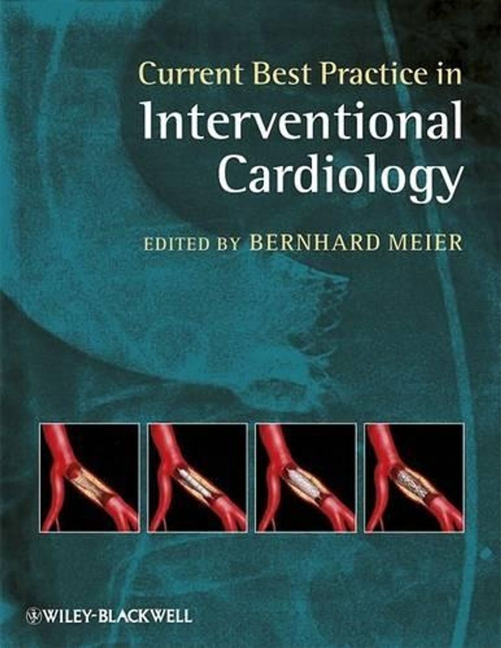 Current Best Practice in Interventional Cardiology, 1st Edition by ...
