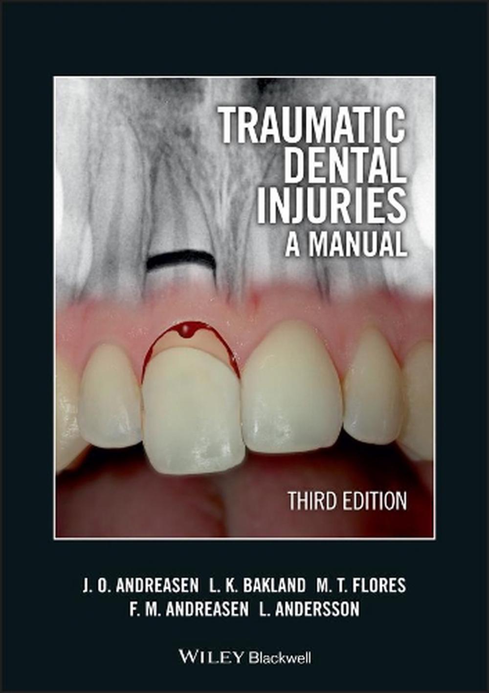 Traumatic Dental Injuries, 3rd Edition, 9781405190619