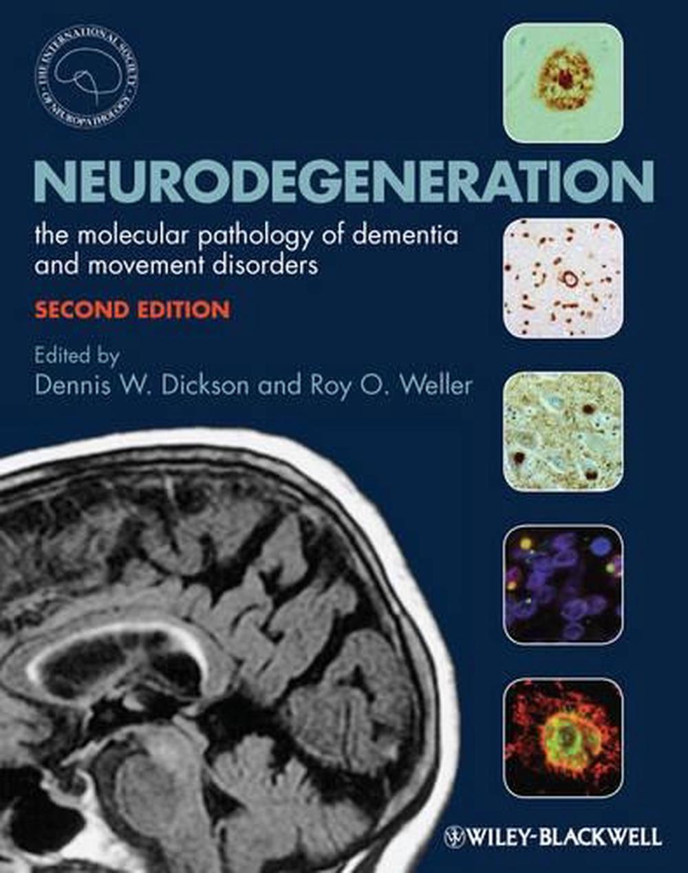 Neurodegeneration, 2nd Edition, 9781405196932