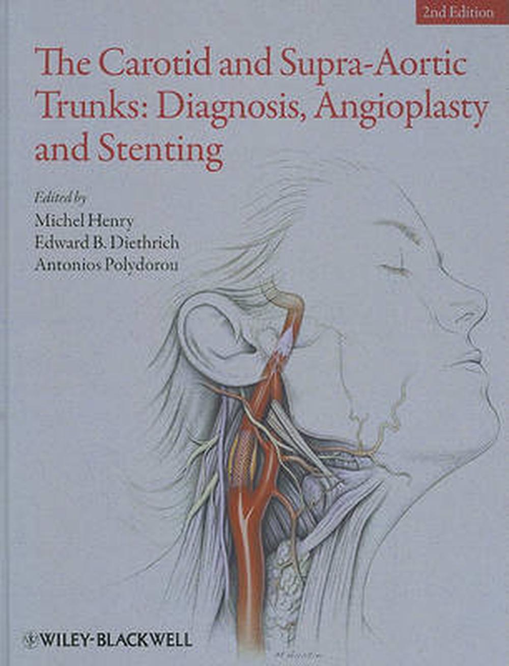 The Carotid and Supra-Aortic Trunks, 9781405198547