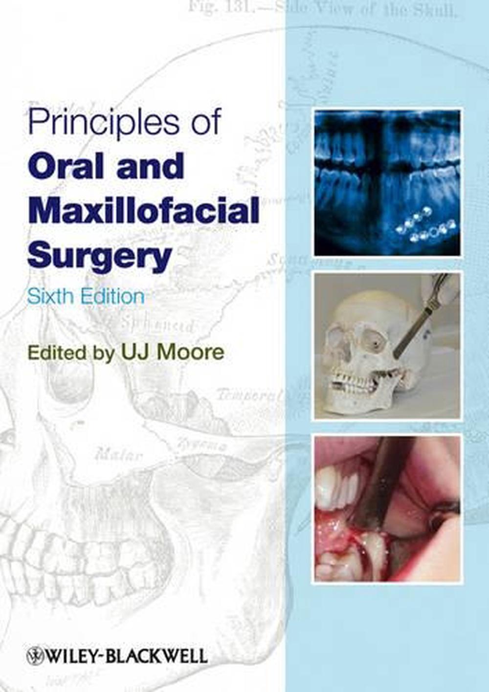 Principles of Oral and Maxillofacial Surgery, 6th Edition, 9781405199988