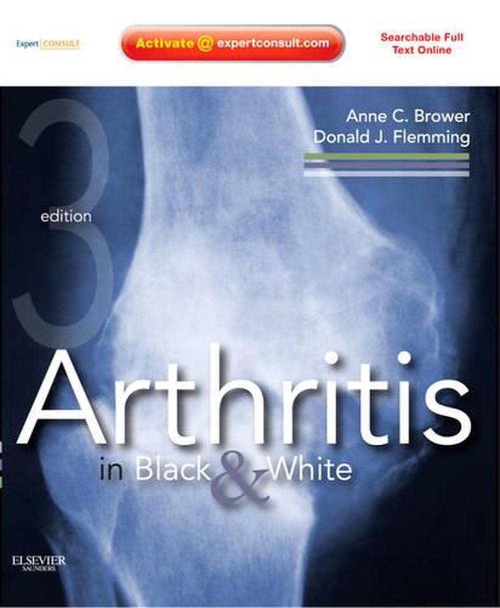 Arthritis in Black and White, 3rd Edition, 9781416055952