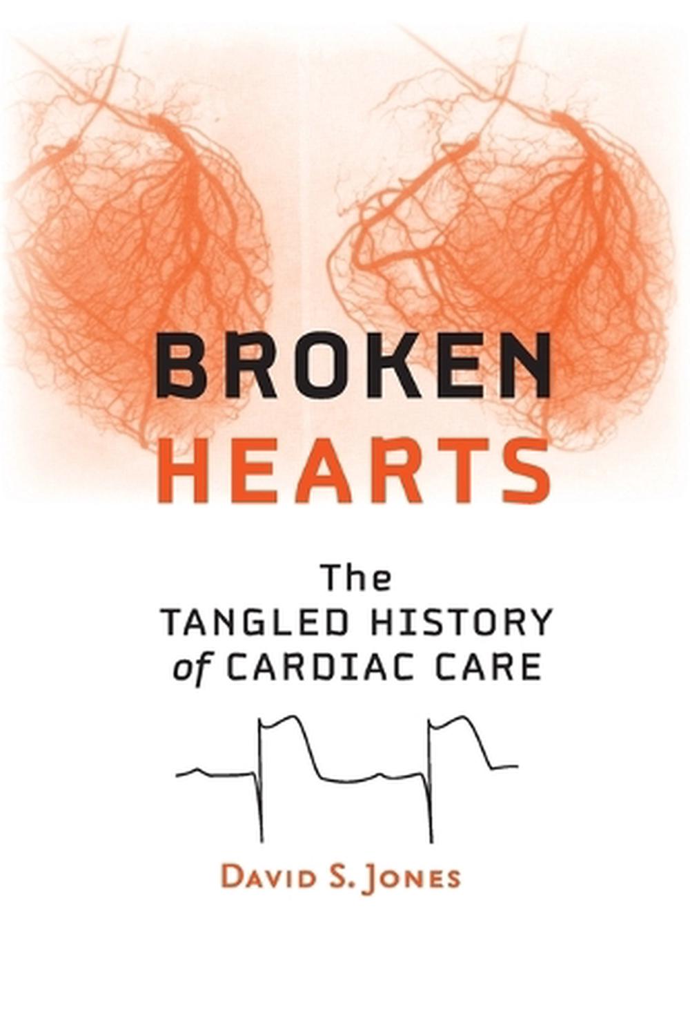 Broken Hearts by David S. Jones - ISBN: 9781421415758
