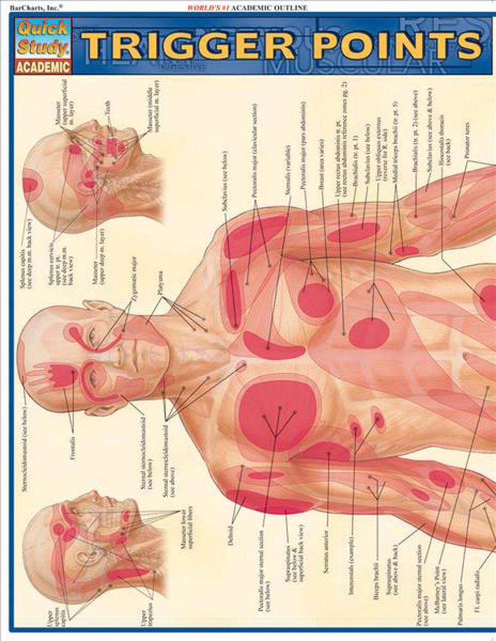 Trigger Points, 9781423203162