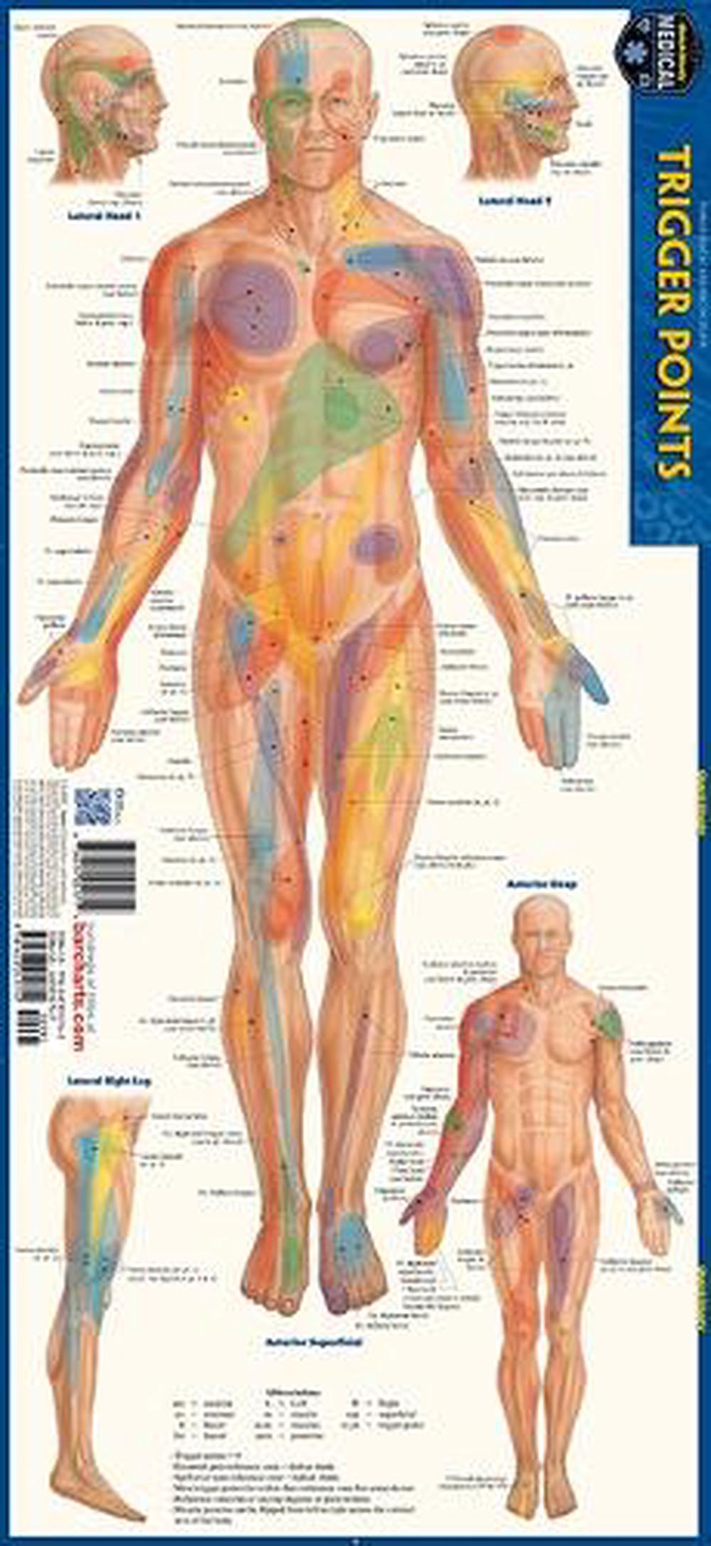 Trigger Points, 9781423251712