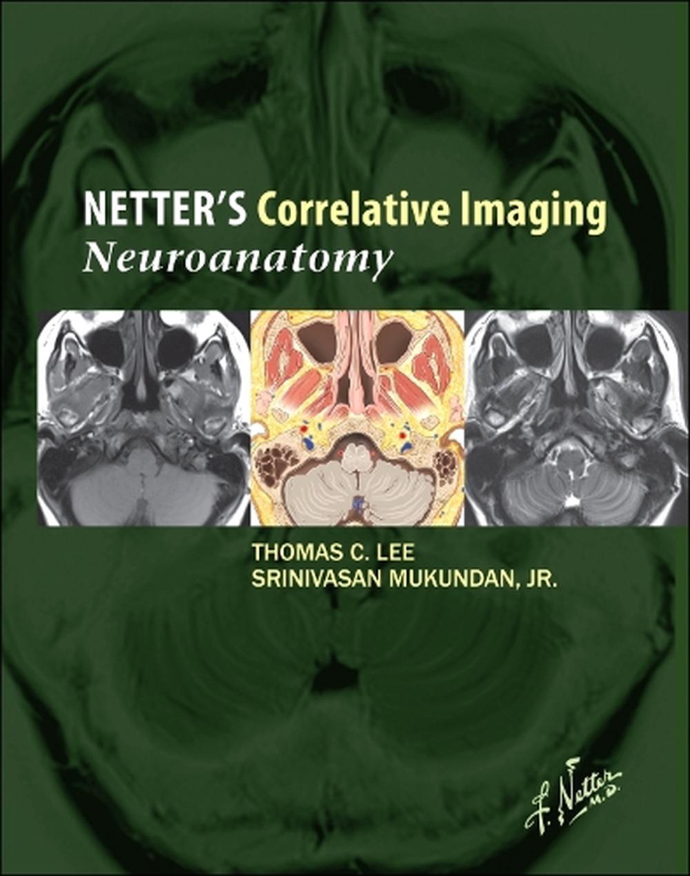 Netter's Correlative Imaging: Neuroanatomy, 9781437704150