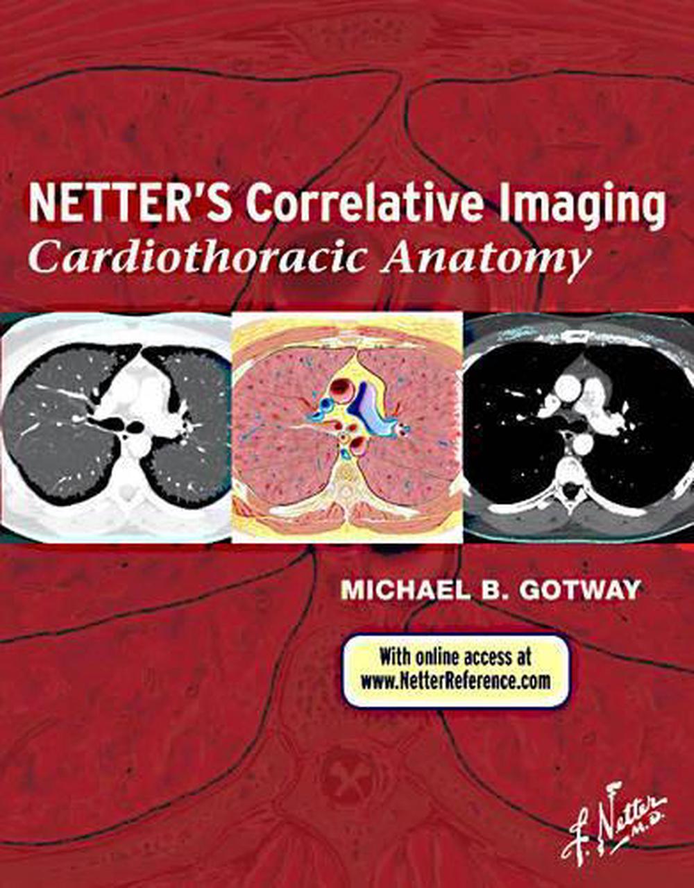 Netter's Correlative Imaging: Cardiothoracic Anatomy, 9781437704402