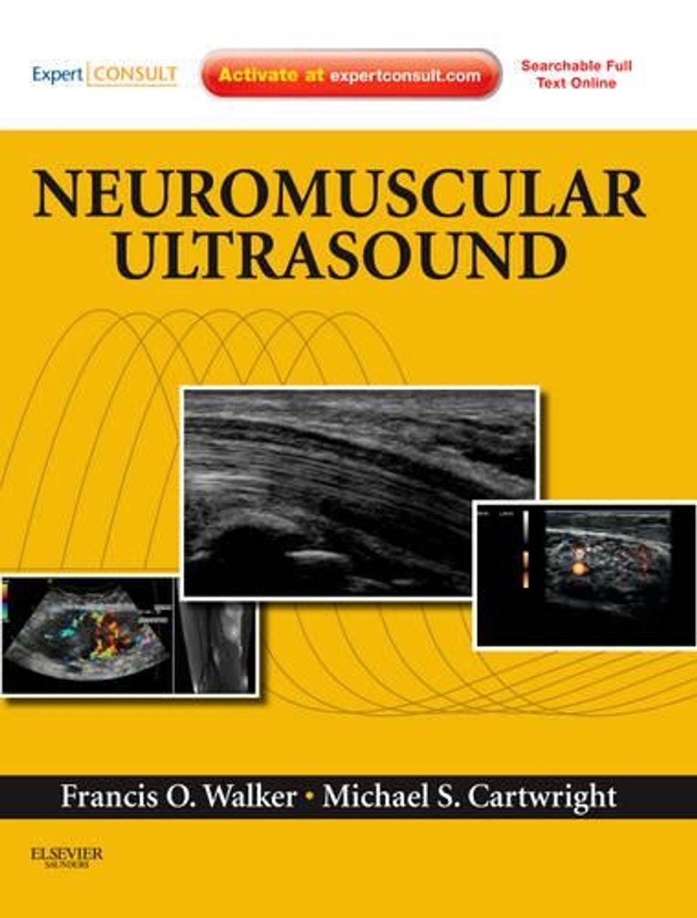 Neuromuscular Ultrasound by Michael S. Cartwright - ISBN: 9781437715279