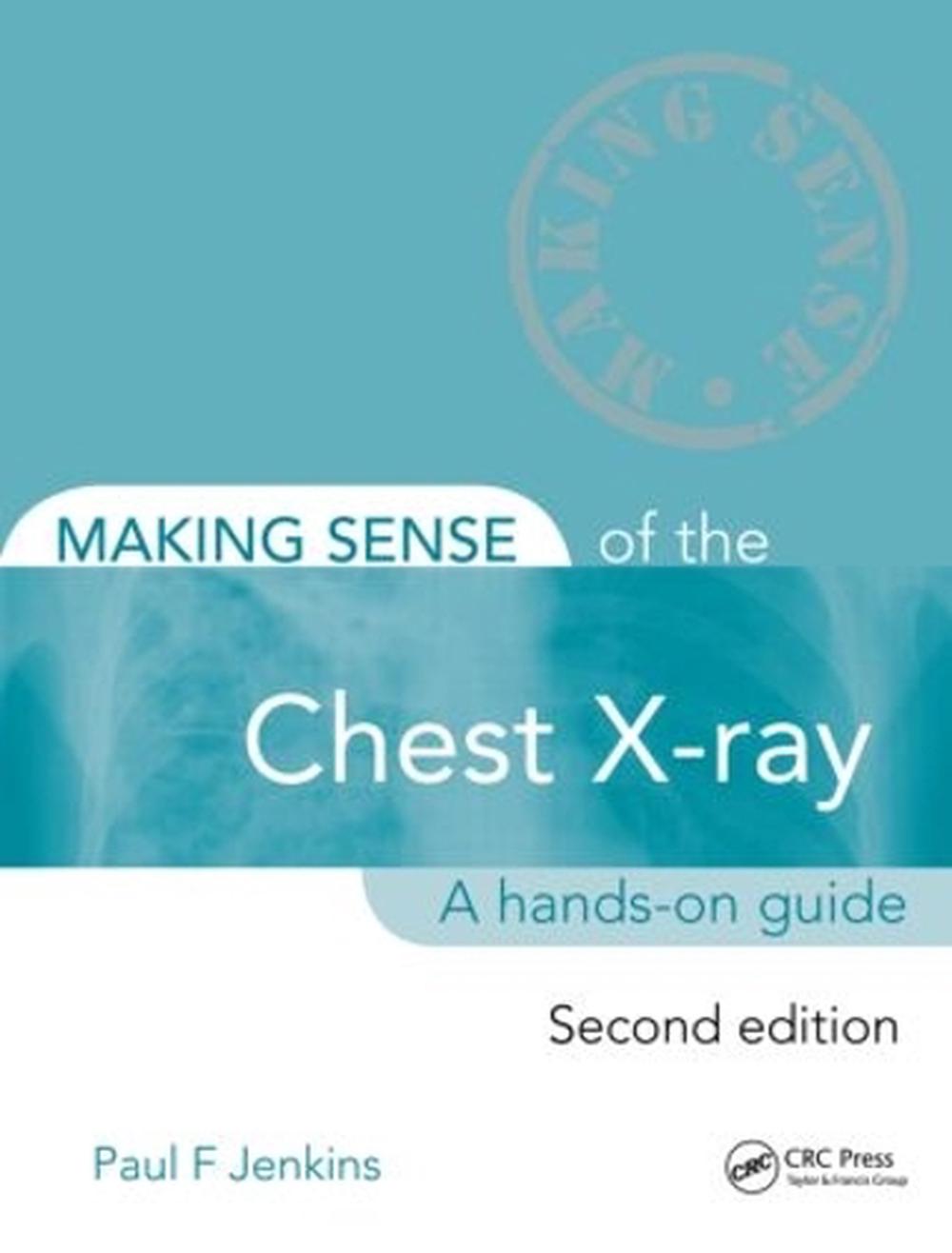Making Sense of the Chest X-ray, 2nd Edition, 9781444135152