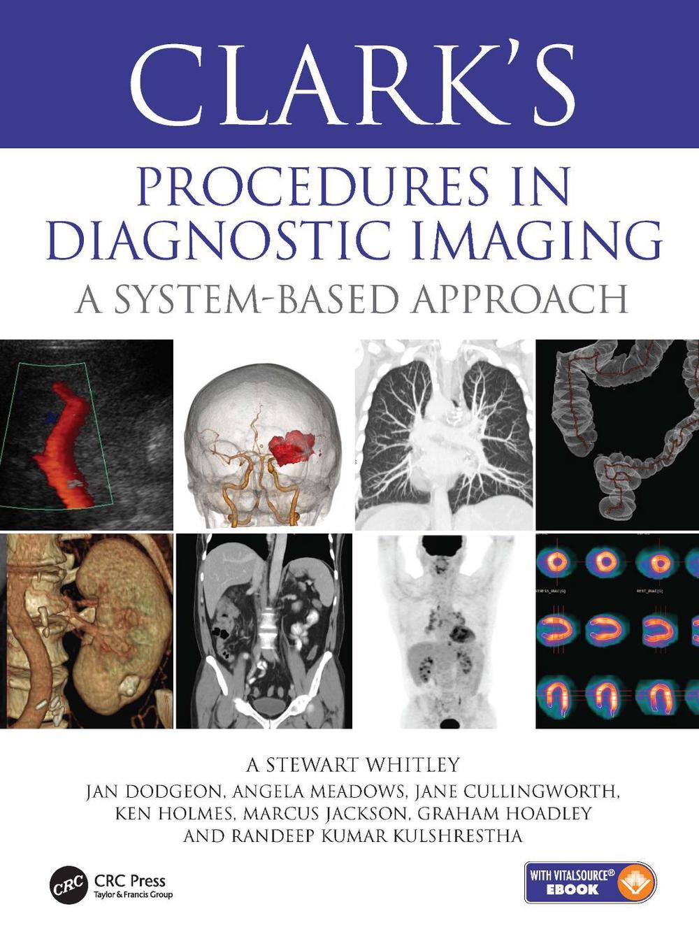 Clark’s Procedures in Diagnostic Imaging, 9781444137224
