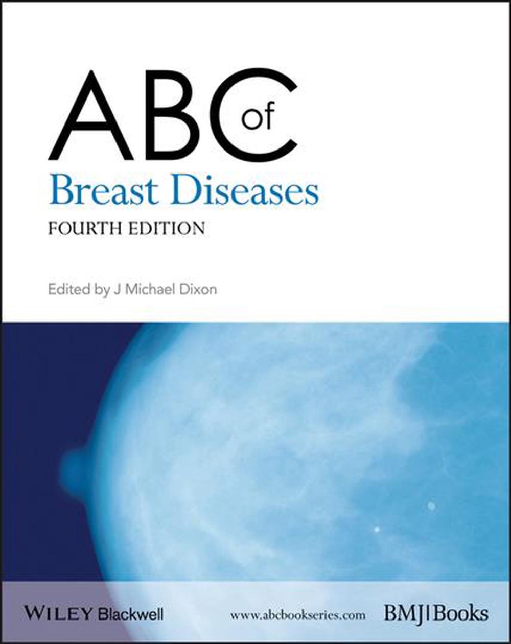 ABC of Breast Diseases, 9781444337969