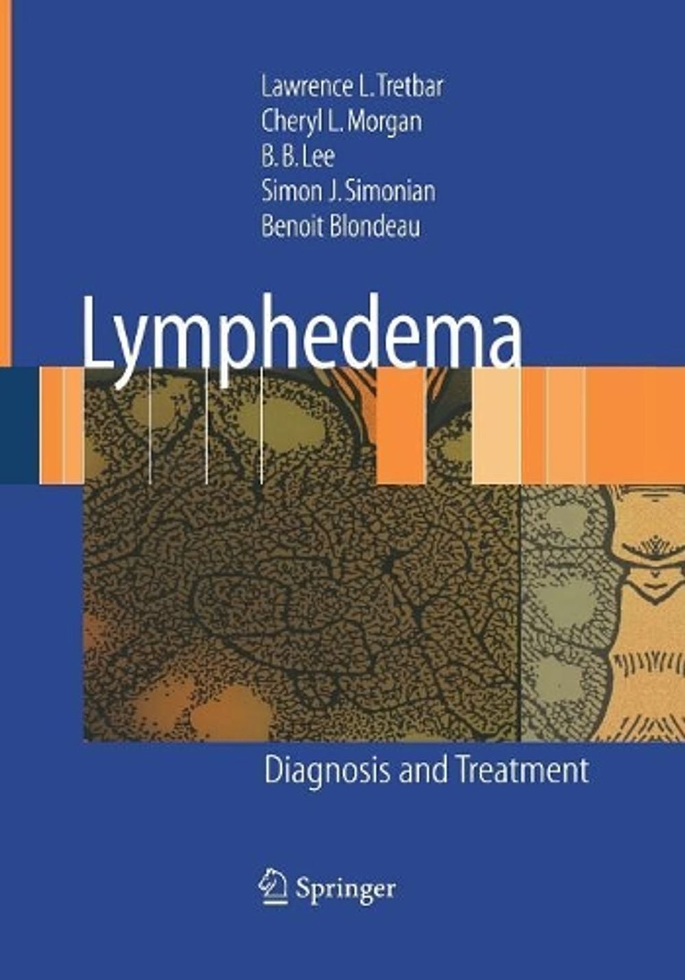Lymphedema by Lawrence L. Tretbar - ISBN: 9781447168171