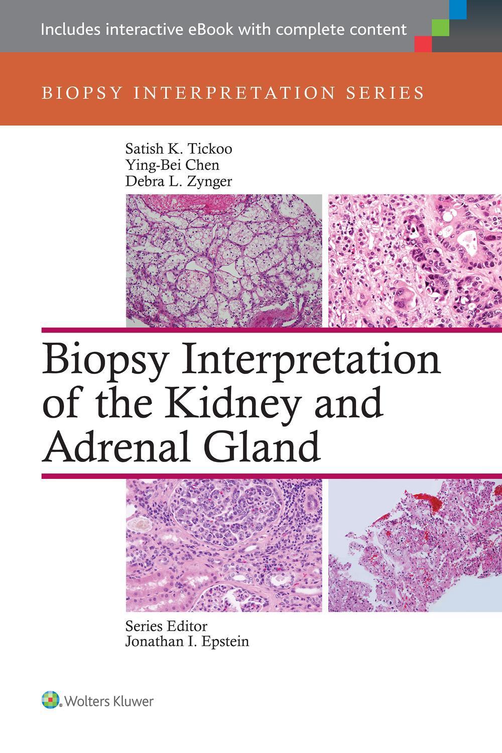 Biopsy Interpretation of the Kidney & Adrenal Gland, 1st Edition, 9781451176476