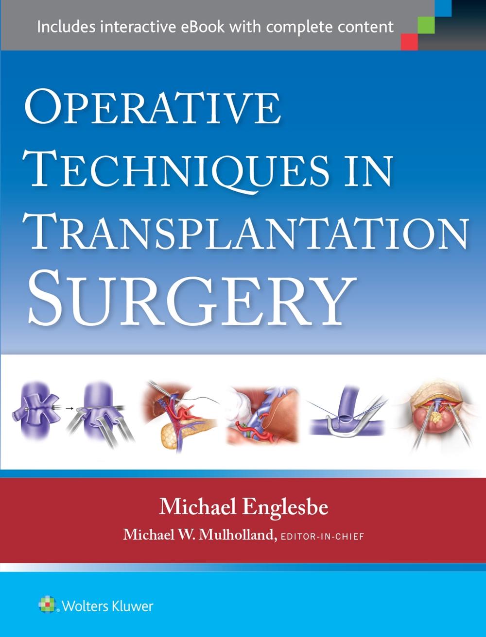 Operative Techniques in Transplantation Surgery, 9781451188745