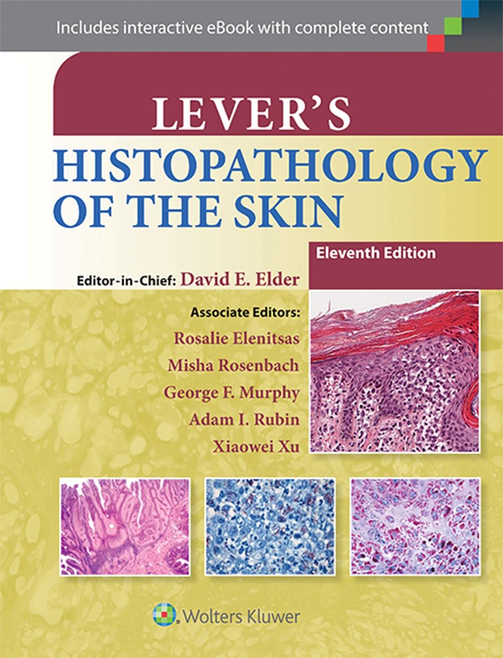 Lever's Histopathology of the Skin by David E. Elder, Hardcover, 9781451190373 Buy online at