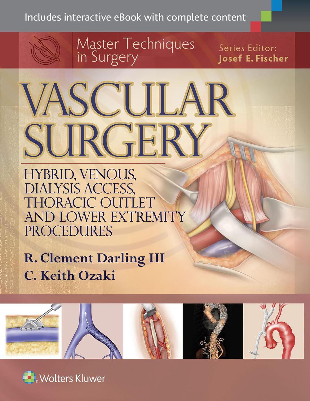 Master Techniques in Surgery: Vascular Surgery: Hybrid, Venous, Dialysis Access, Thoracic Outlet, and Lower Extremity Procedures, 9781451191578