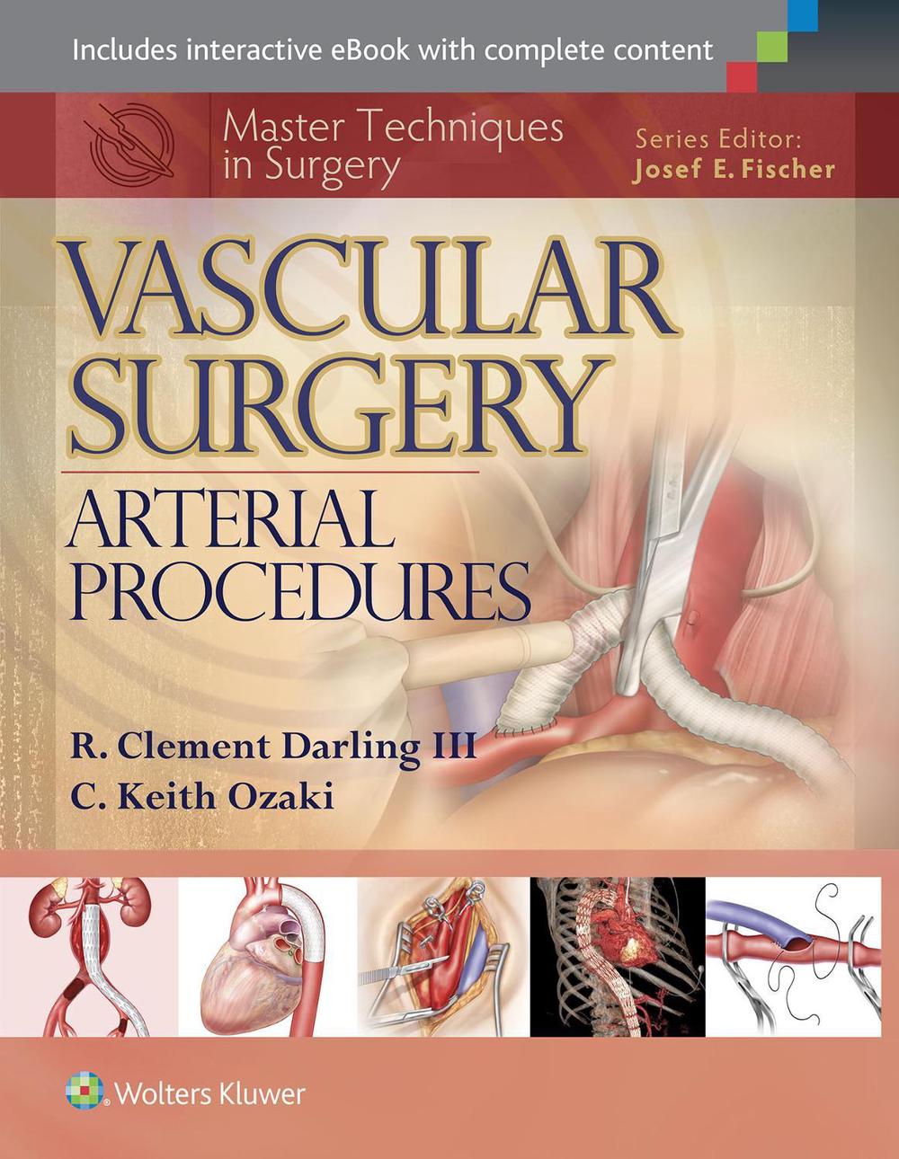 Master Techniques in Surgery: Vascular Surgery: Arterial Procedures, 9781451191615