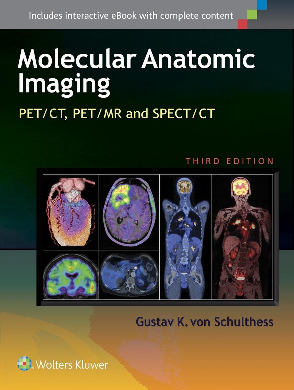 Molecular Anatomic Imaging, 3rd Edition by Gustav K. von Schulthess - ISBN: 9781451192667