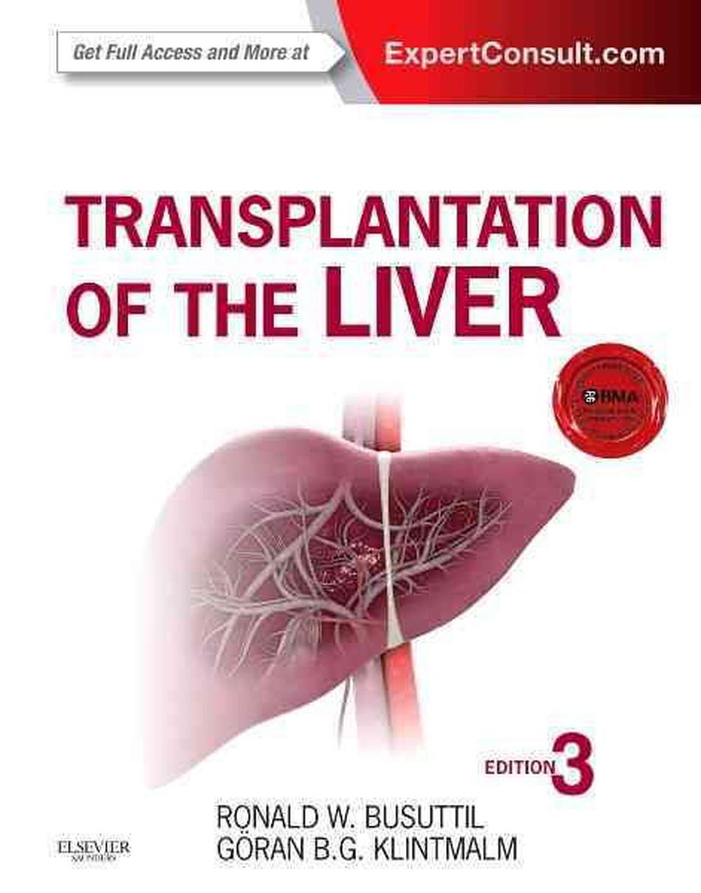 Transplantation of the Liver, 9781455702688