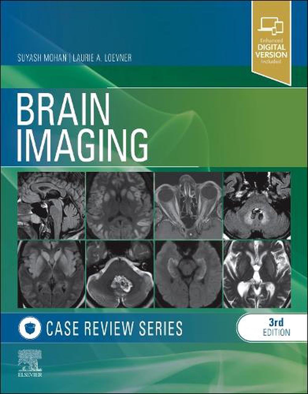 Brain Imaging, 3rd Edition, 9781455774852