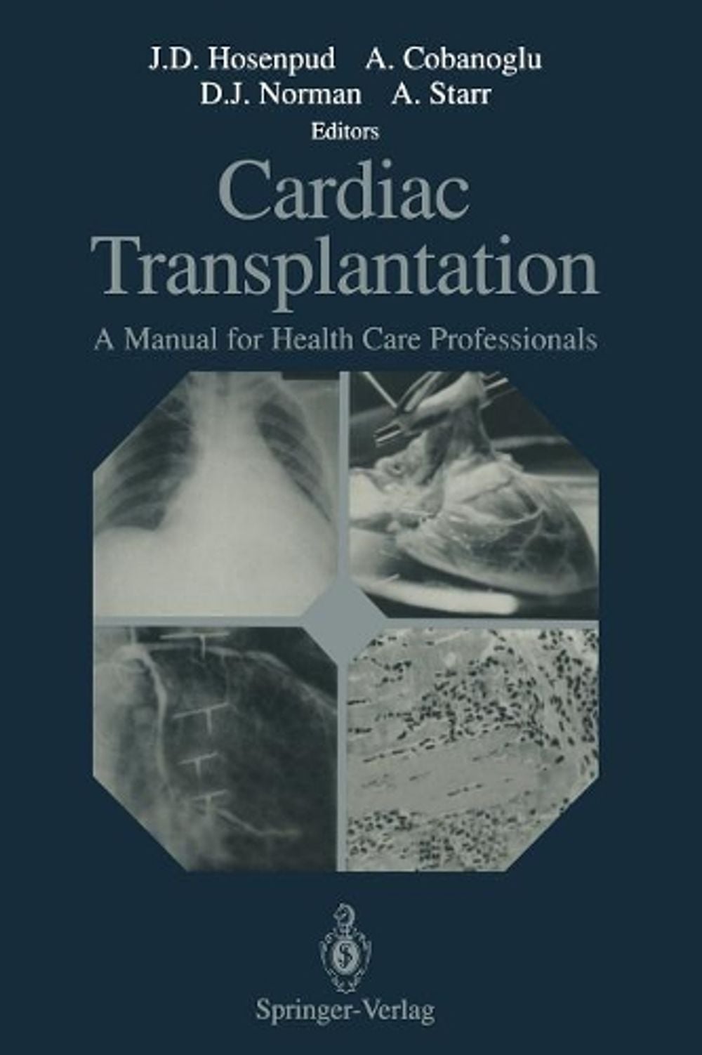 Cardiac Transplantation by Jeffrey D. Hosenpud - ISBN: 9781461277576