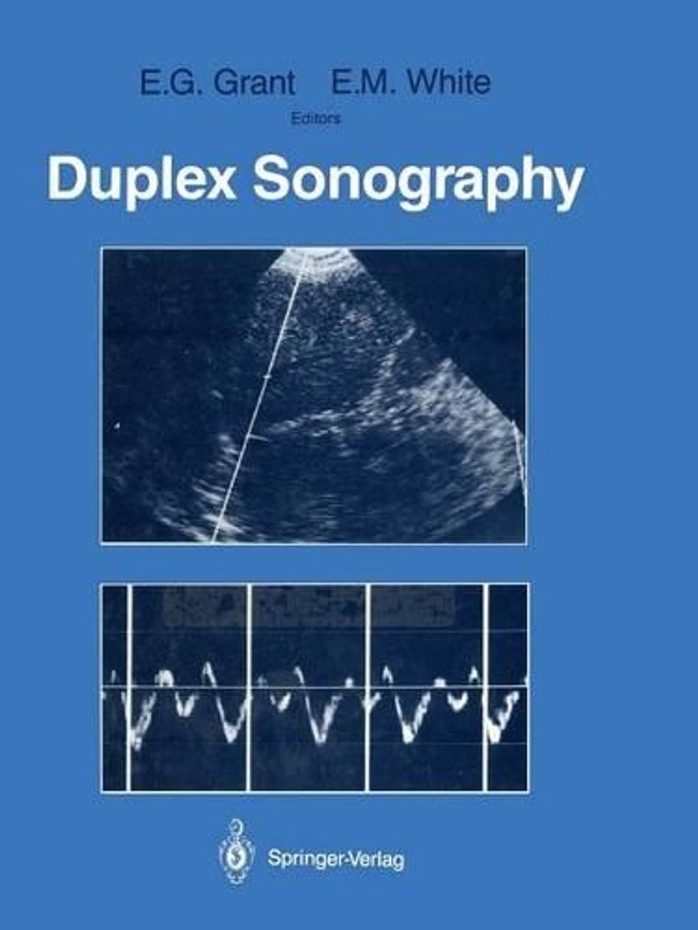 Duplex Sonography by Edward G. Grant - ISBN: 9781461283331