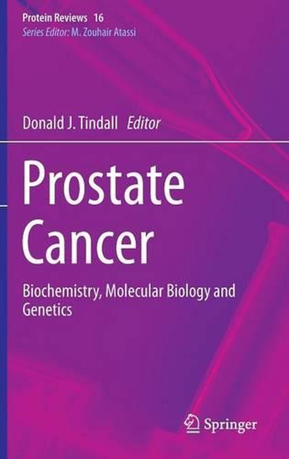Prostate Cancer, 2013th Edition, 9781461468271