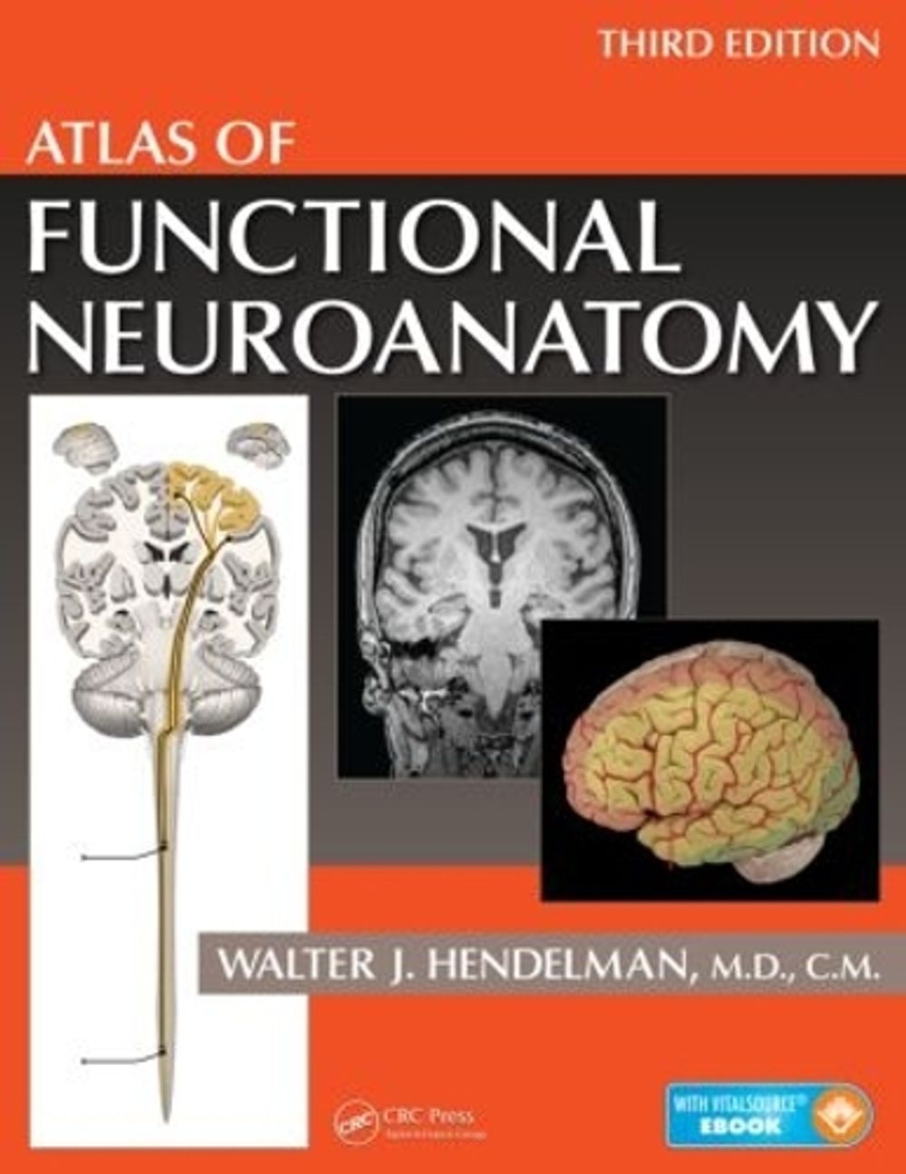 Atlas of Functional Neuroanatomy, 3rd Edition by Walter Hendelman M.D. - ISBN: 9781466585348