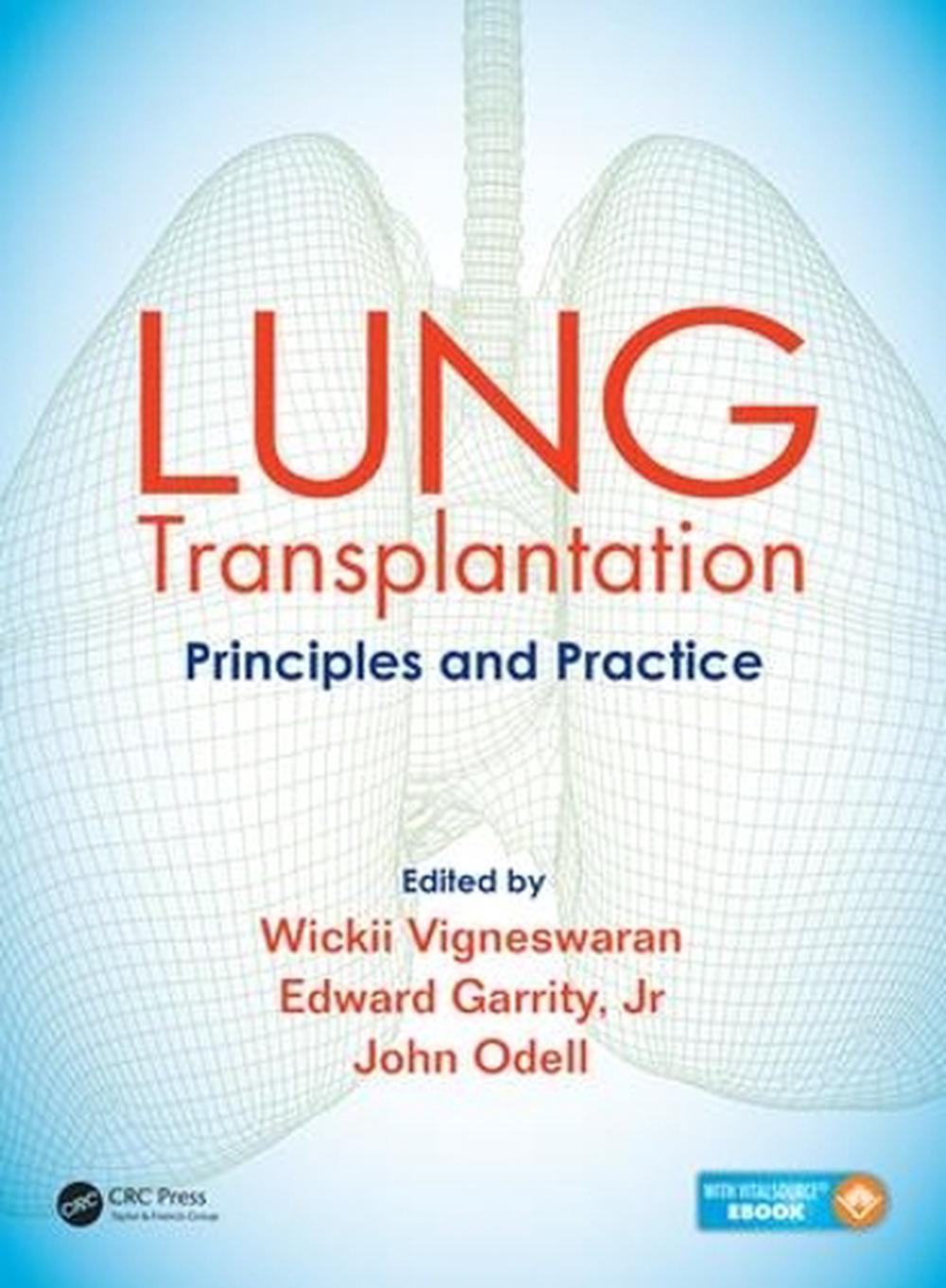 Lung Transplantation, 9781482233919