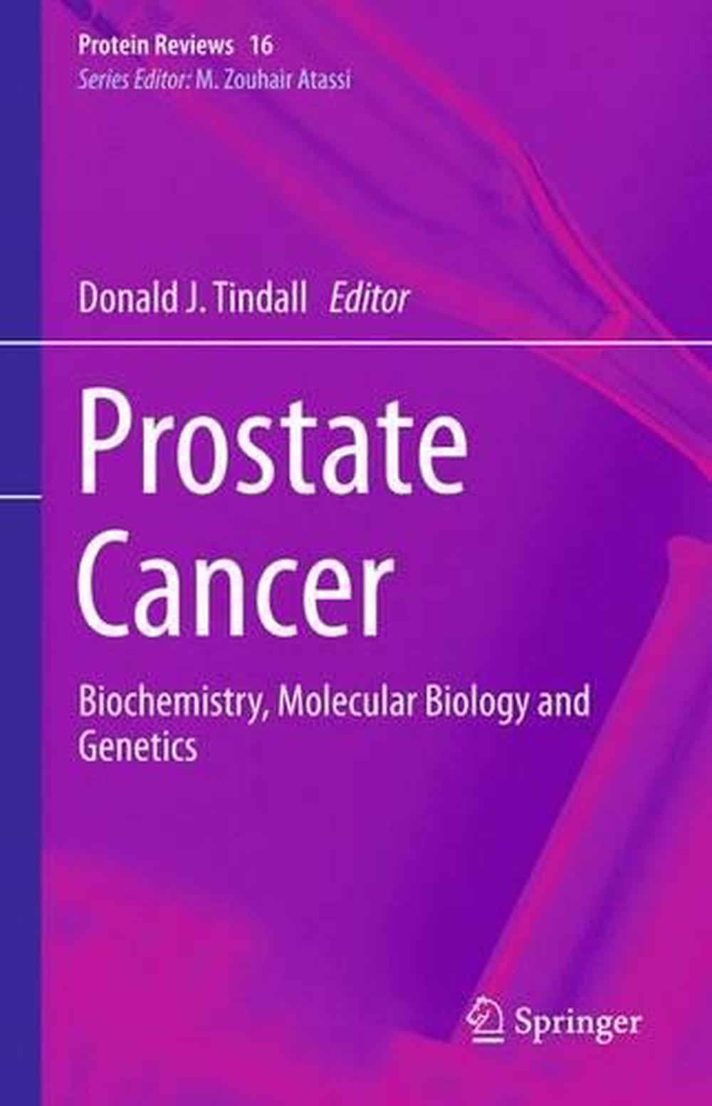 Prostate Cancer, 2013th Edition, 9781489986627