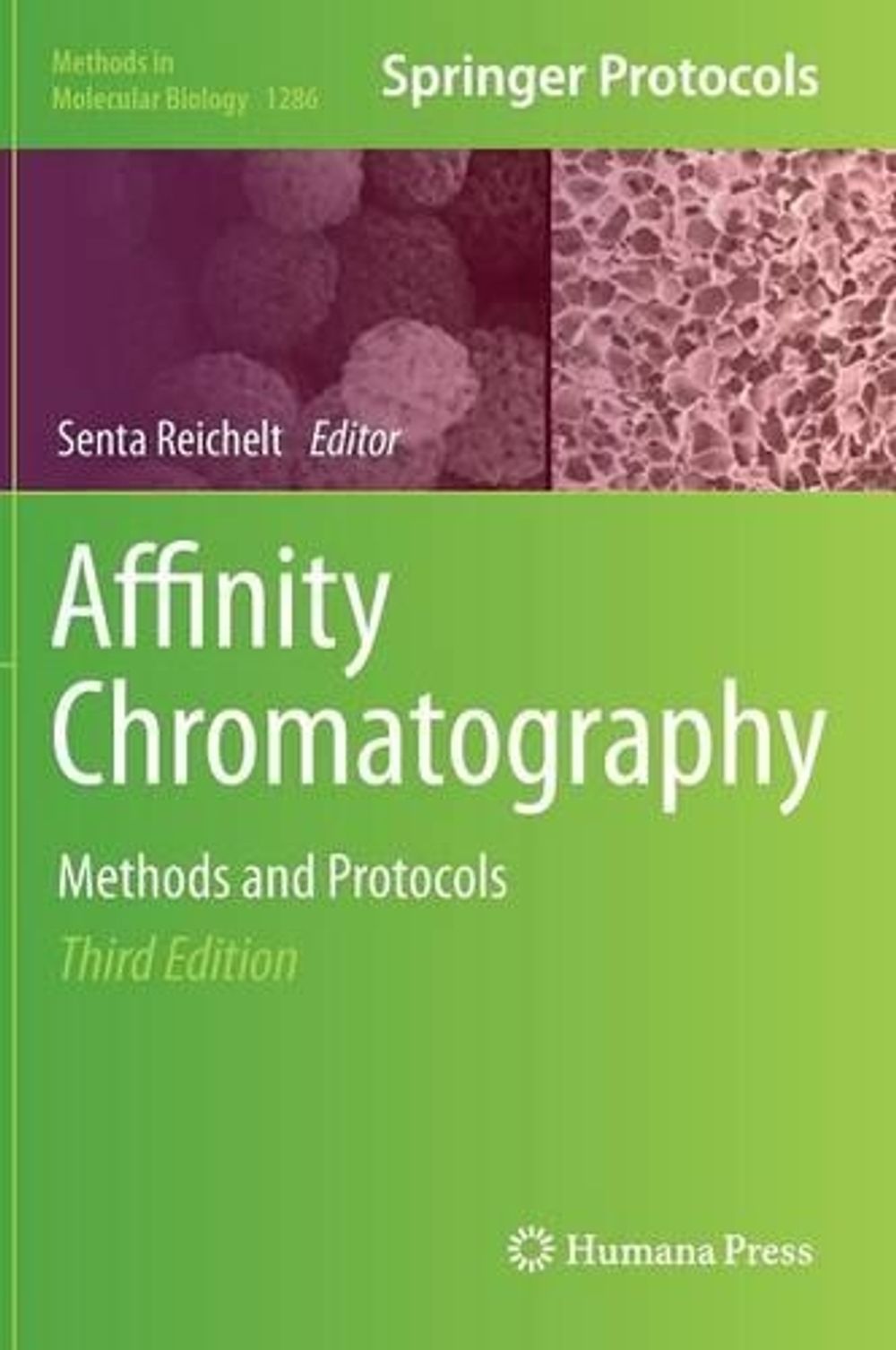 Affinity Chromatography by Senta Reichelt - ISBN: 9781493924462