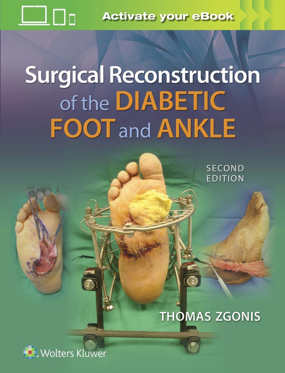 Surgical Reconstruction of the Diabetic Foot and Ankle, 9781496330079