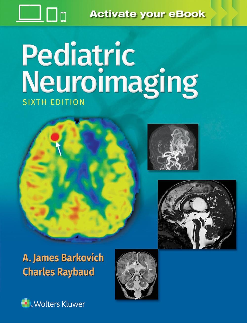 Pediatric Neuroimaging, 6th Edition by Charles Raybaud - ISBN: 9781496337207