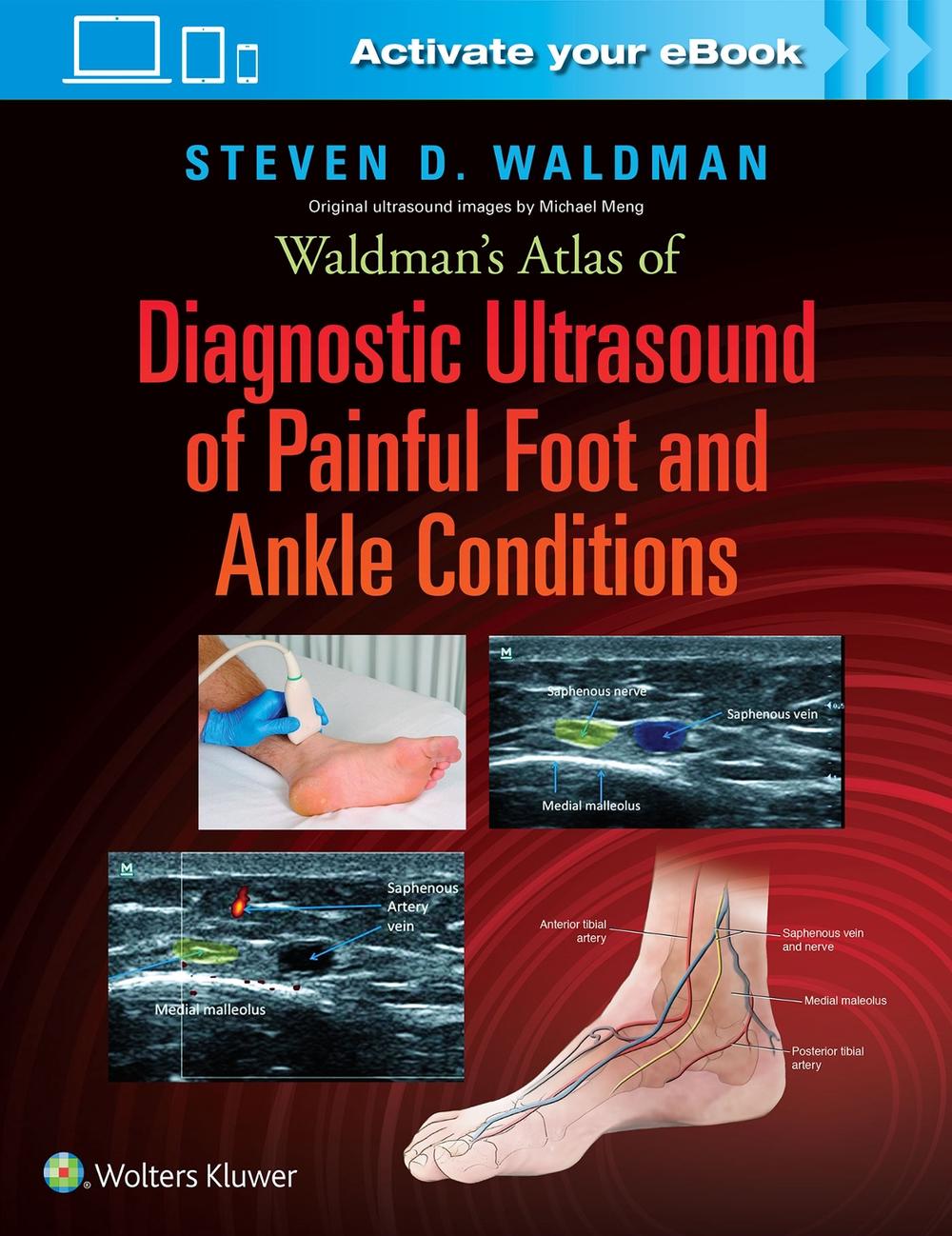 Waldman's Atlas of Diagnostic Ultrasound of Painful Foot and Ankle Conditions, 9781496345462