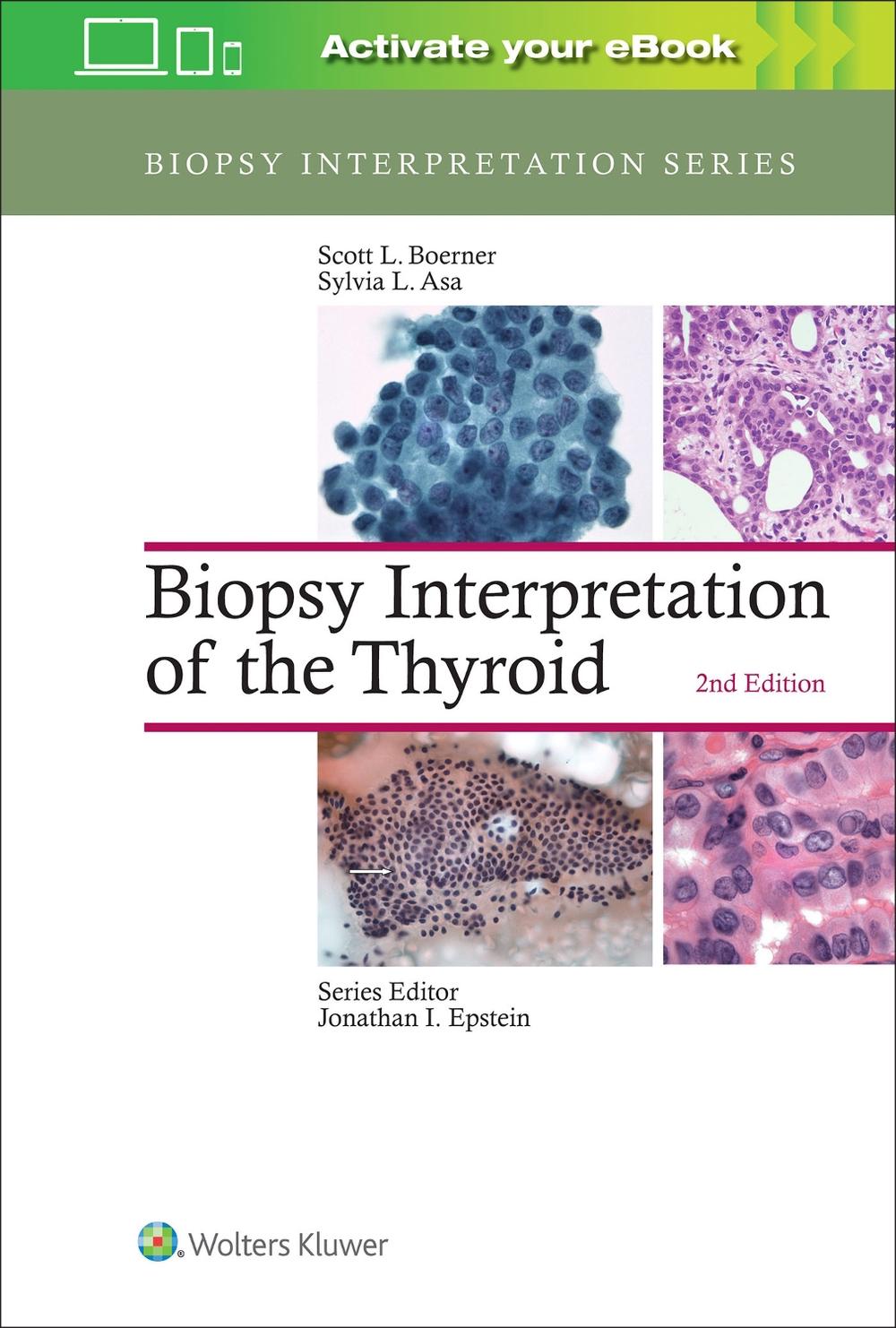 Biopsy Interpretation of the Thyroid, 2nd Edition, 9781496355850