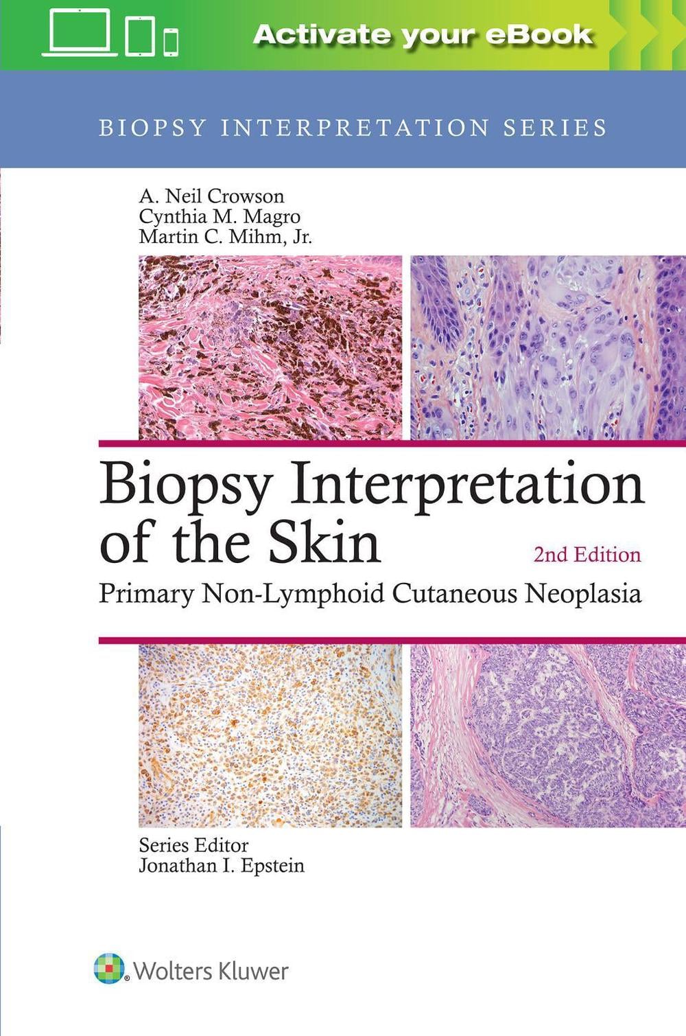 Biopsy Interpretation of the Skin, 2nd Edition by A. Neil Crowson - ISBN: 9781496365132