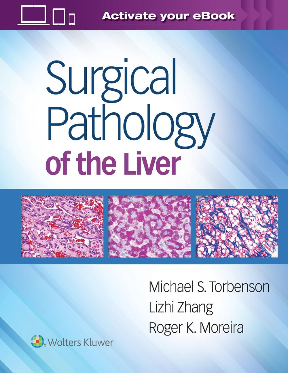 Surgical Pathology of the Liver, 9781496365798