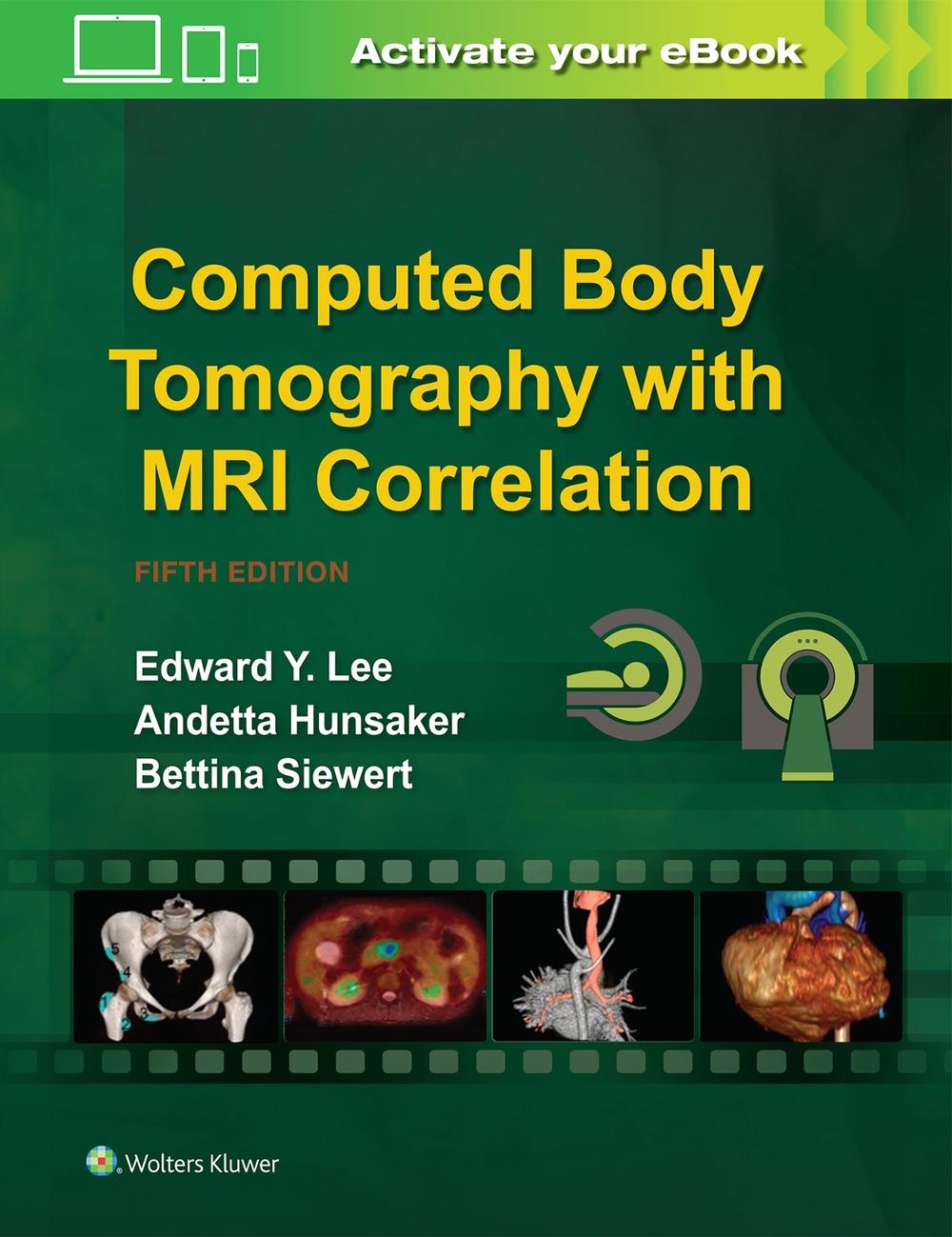 Computed Body Tomography with MRI Correlation, 9781496370495