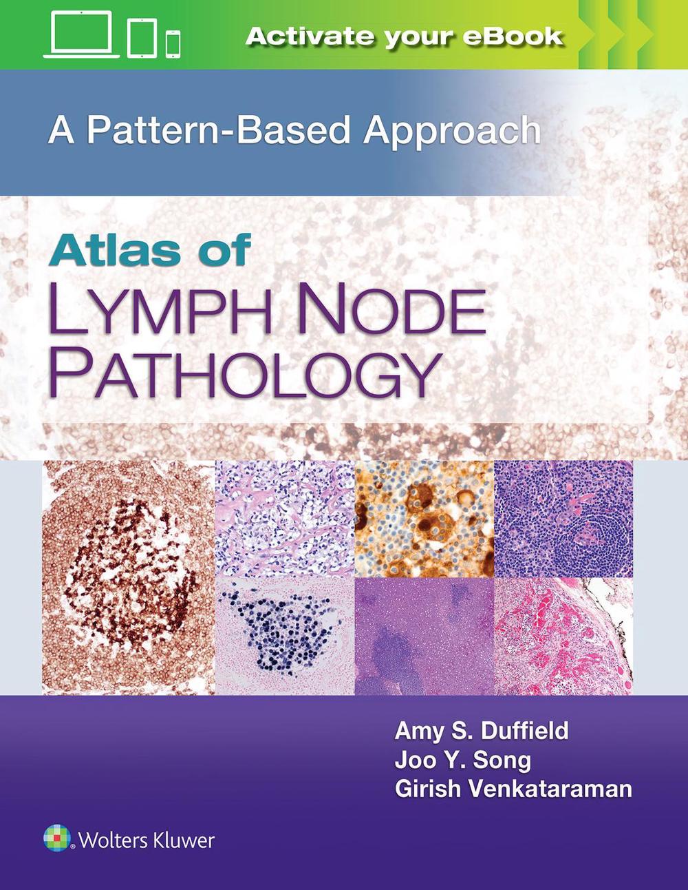 Atlas of Lymph Node Pathology by Amy S. Duffield - ISBN: 9781496375544